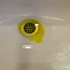 כיור עם סימני נזילה בצבע צהוב