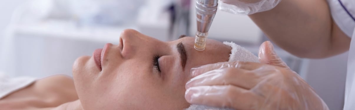 טיפול מיקרונידלינג