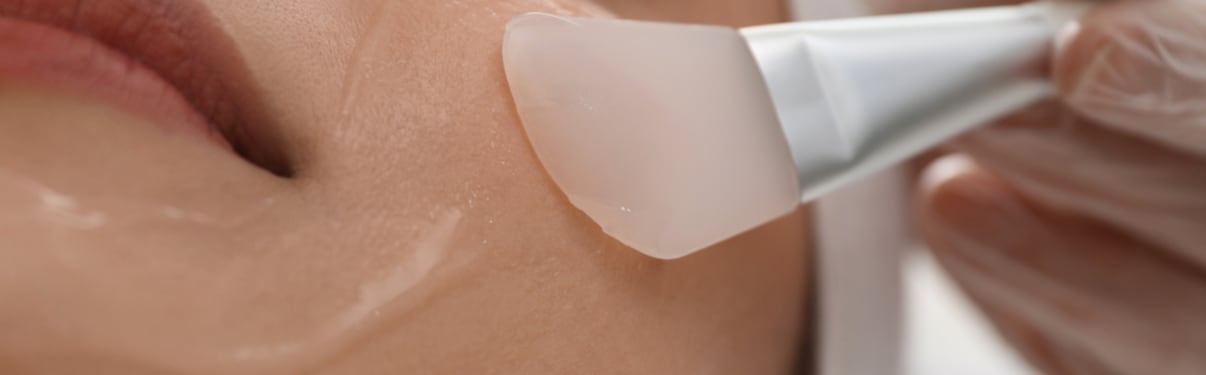 פילינג כימי