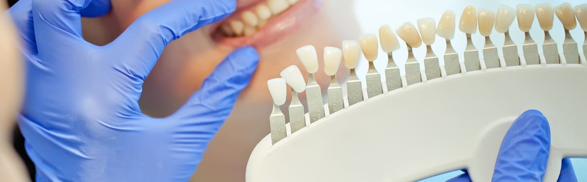 החלפת כתר בשן