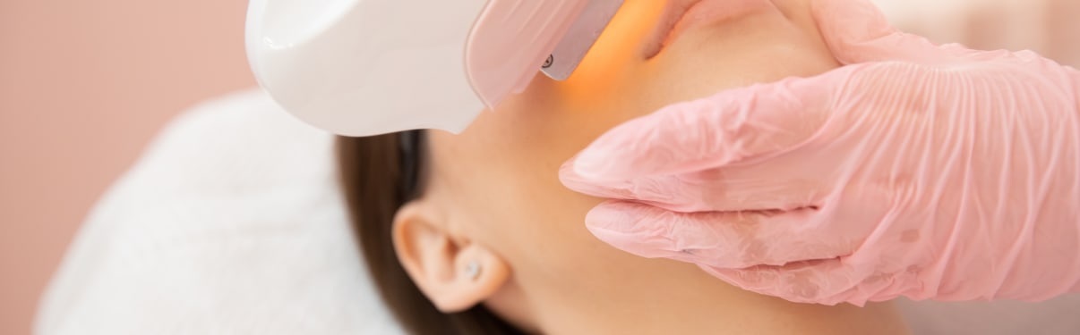 אפילציה בפנים