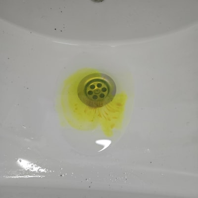 כיור עם כתם צהוב סביב הניקוז