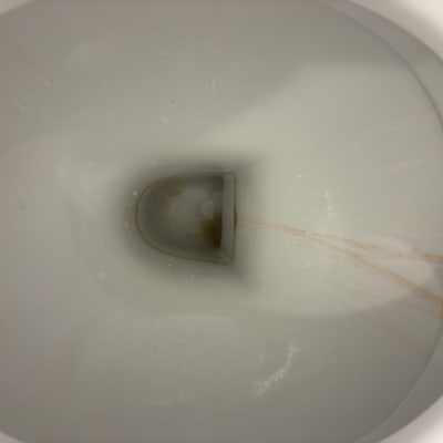 תמונה של פנים אסלה עם כתמי לכלוך