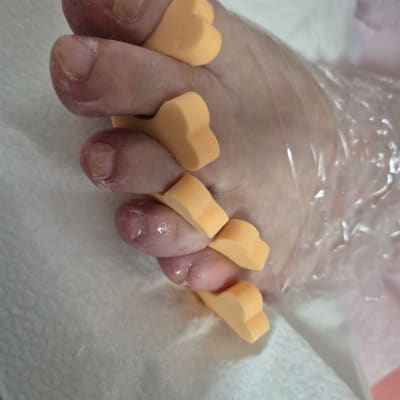 טיפול פדיקור עם מפרידי אצבעות כתומים