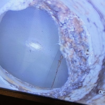 צילום פנים צינור עם סימני נזילה
