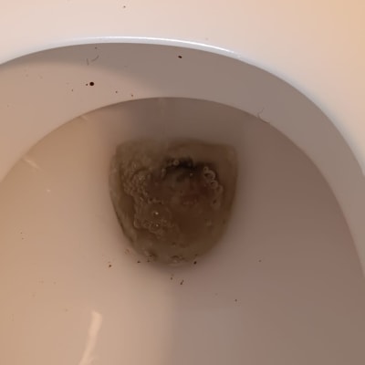 אסלה עם מים עכורים ובועות