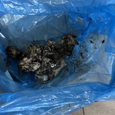 שקית כחולה עם פסולת סתימה שהוצאה מצנרת