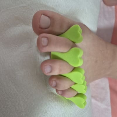 אצבעות רגליים עם מפרידי אצבעות ירוקים
