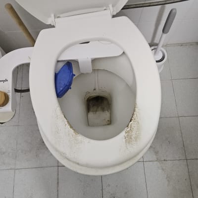 אסלת שירותים מלוכלכת עם כתמים קשים לפני ביצוע ניקיון