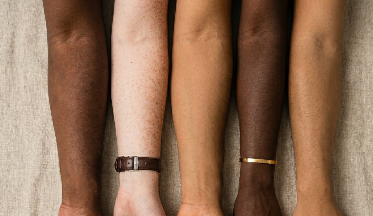 גוונים שונים של צבע עור