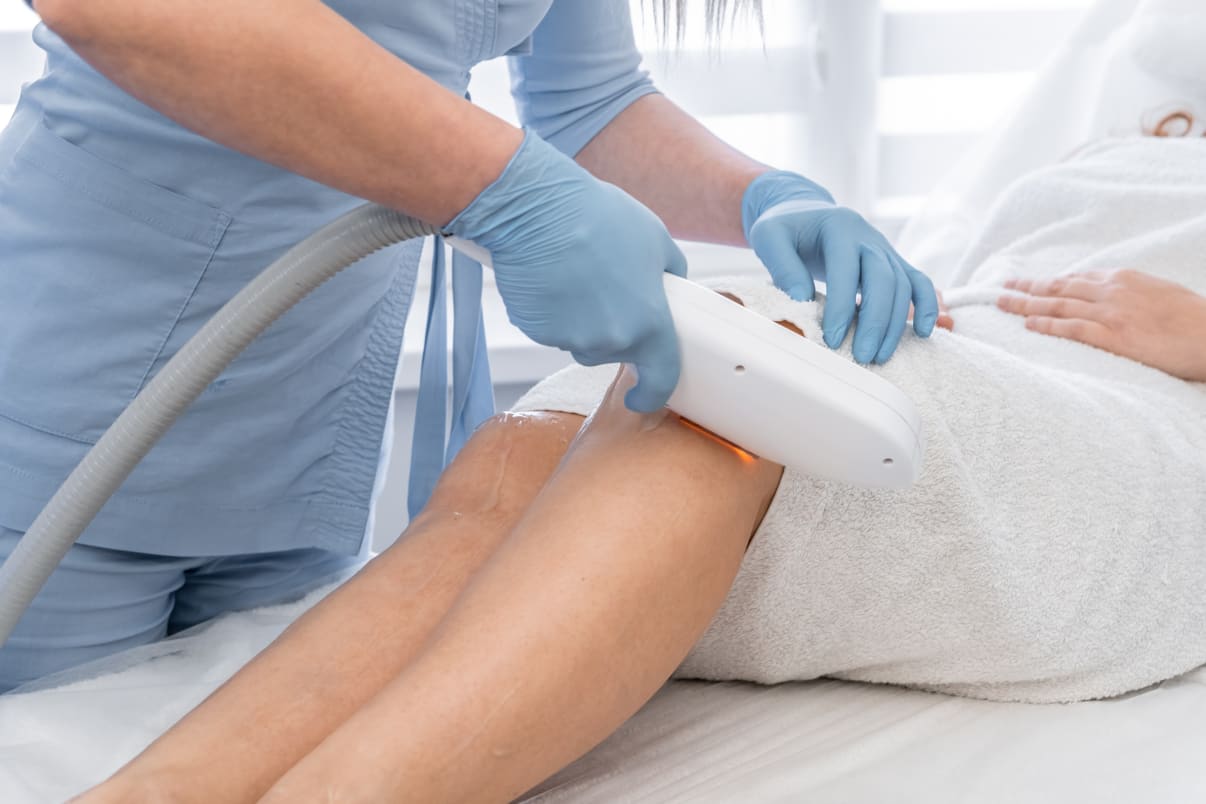 הורדת שיער בלייזר ברגליים הורדת שיער בלייזר ברגליים