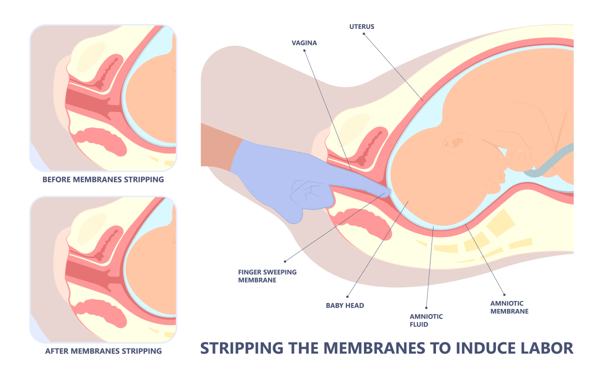 סטריפינג סטריפינג