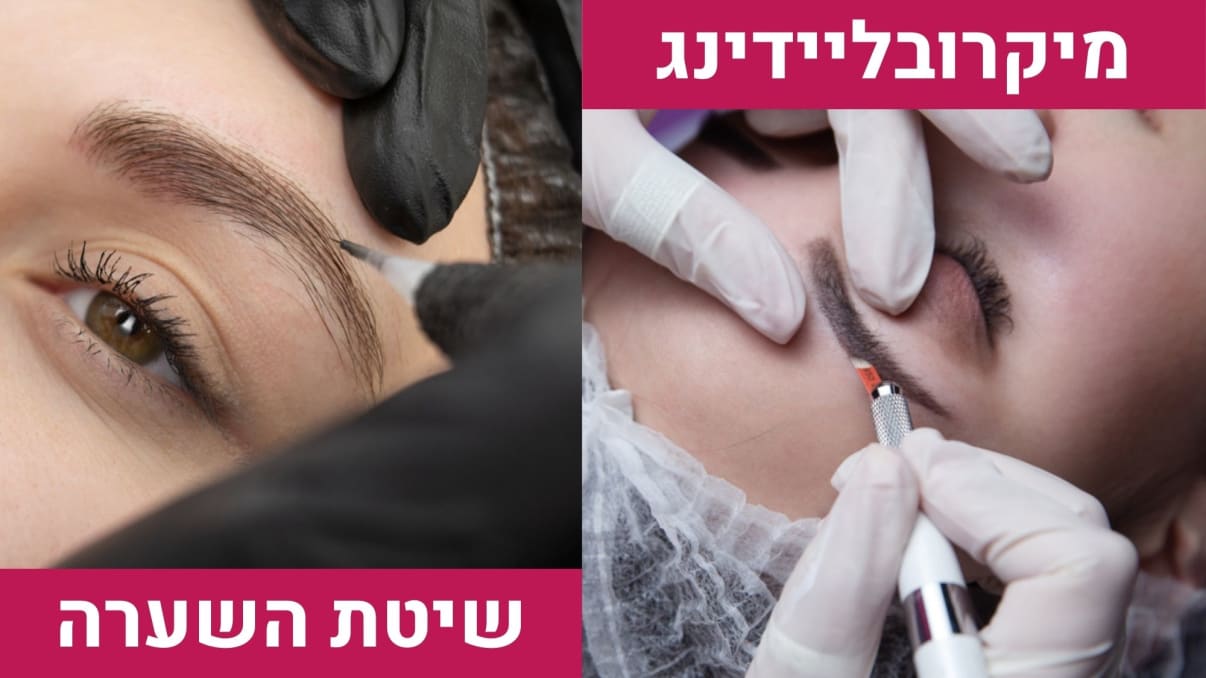 מיקרובליידינג או שיטת השערה מיקרובליידינג או שיטת השערה