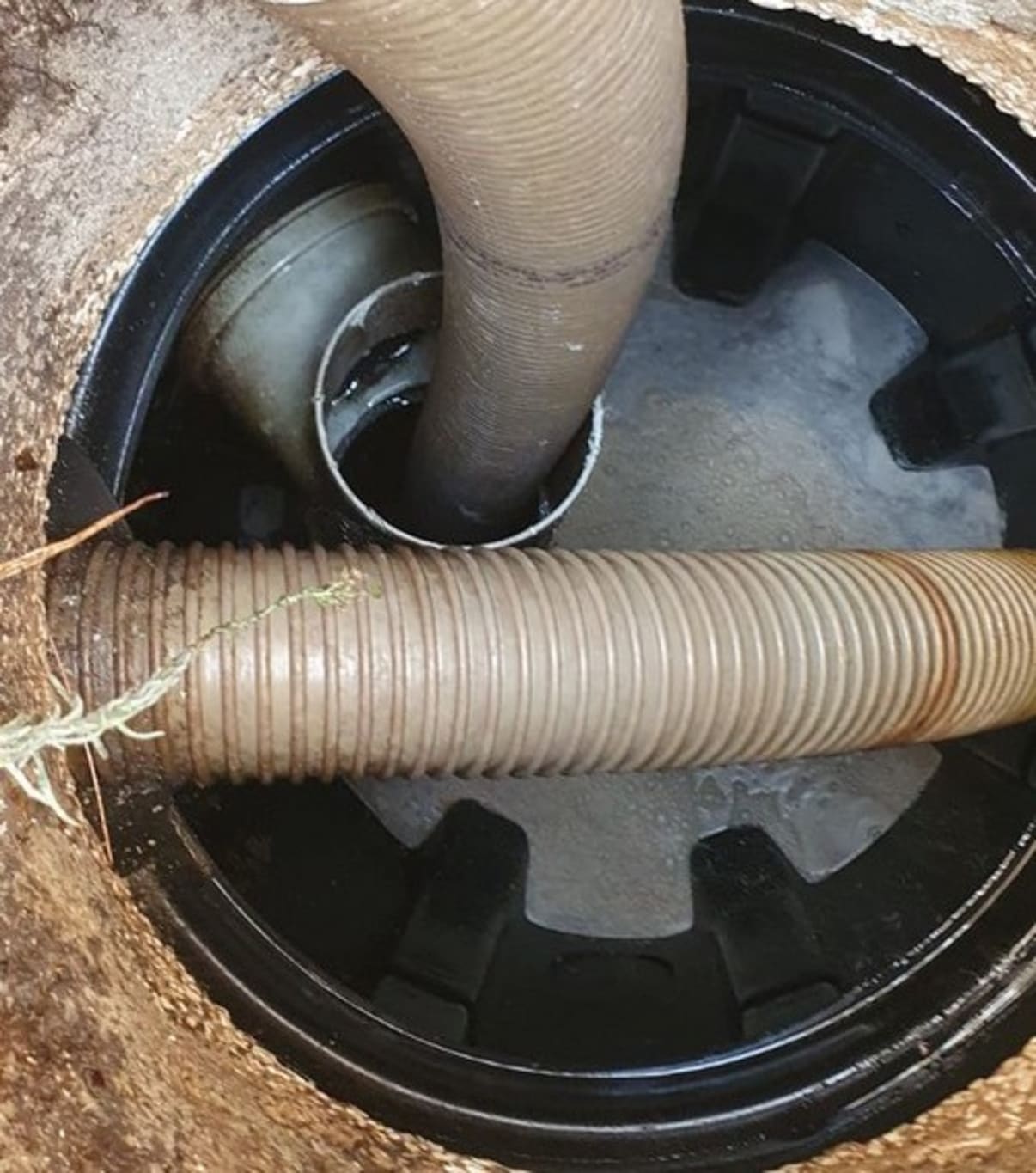 שאיבת בור שומן