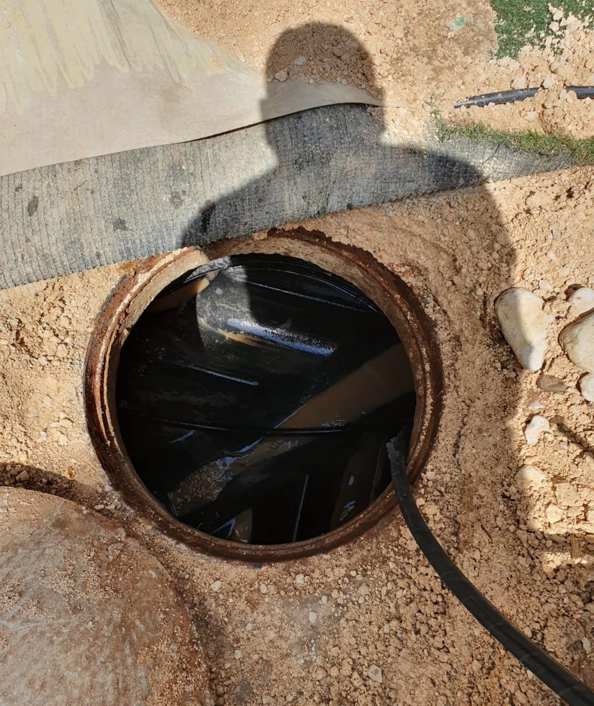 שאיבת בור שומן