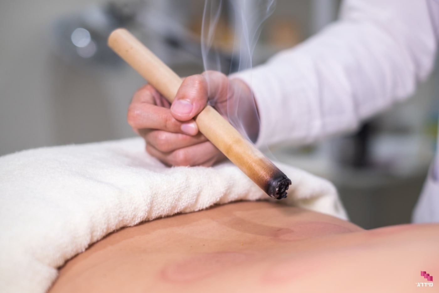 מוקסה להיפוך עובר