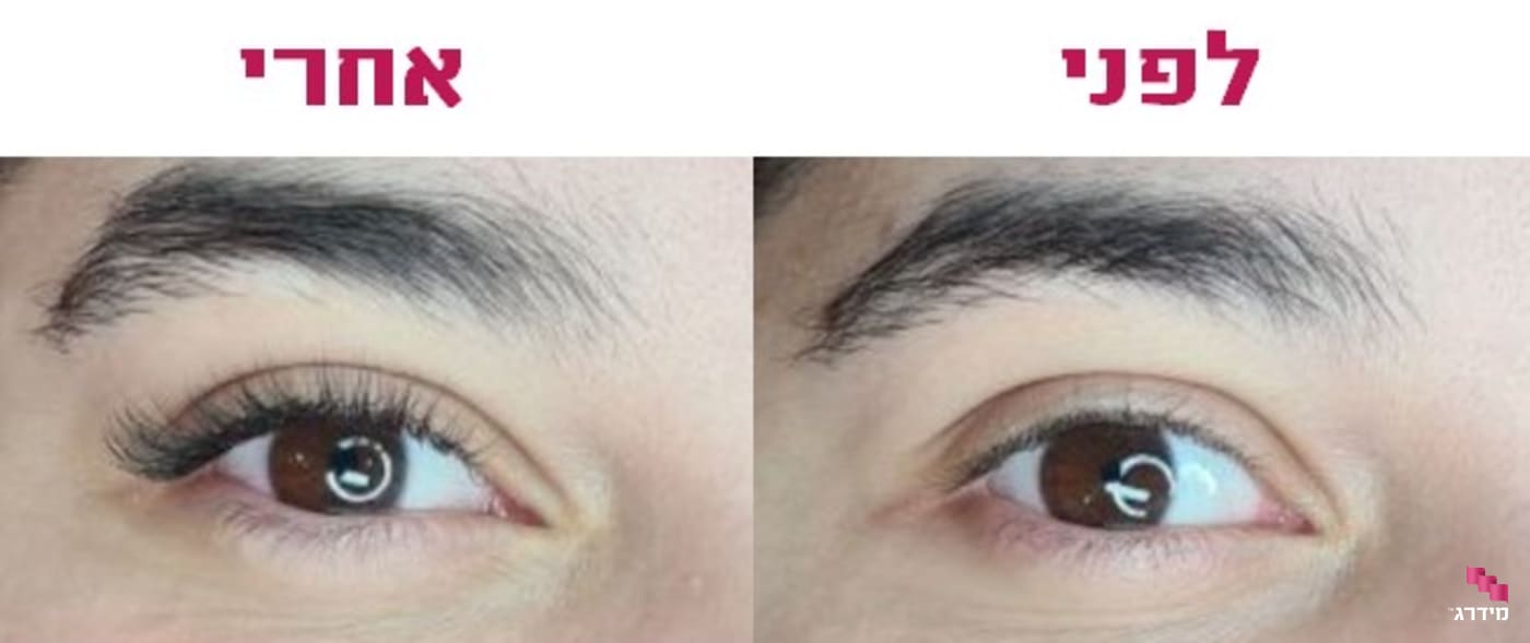 הלחמת ריסים לפני אחרי