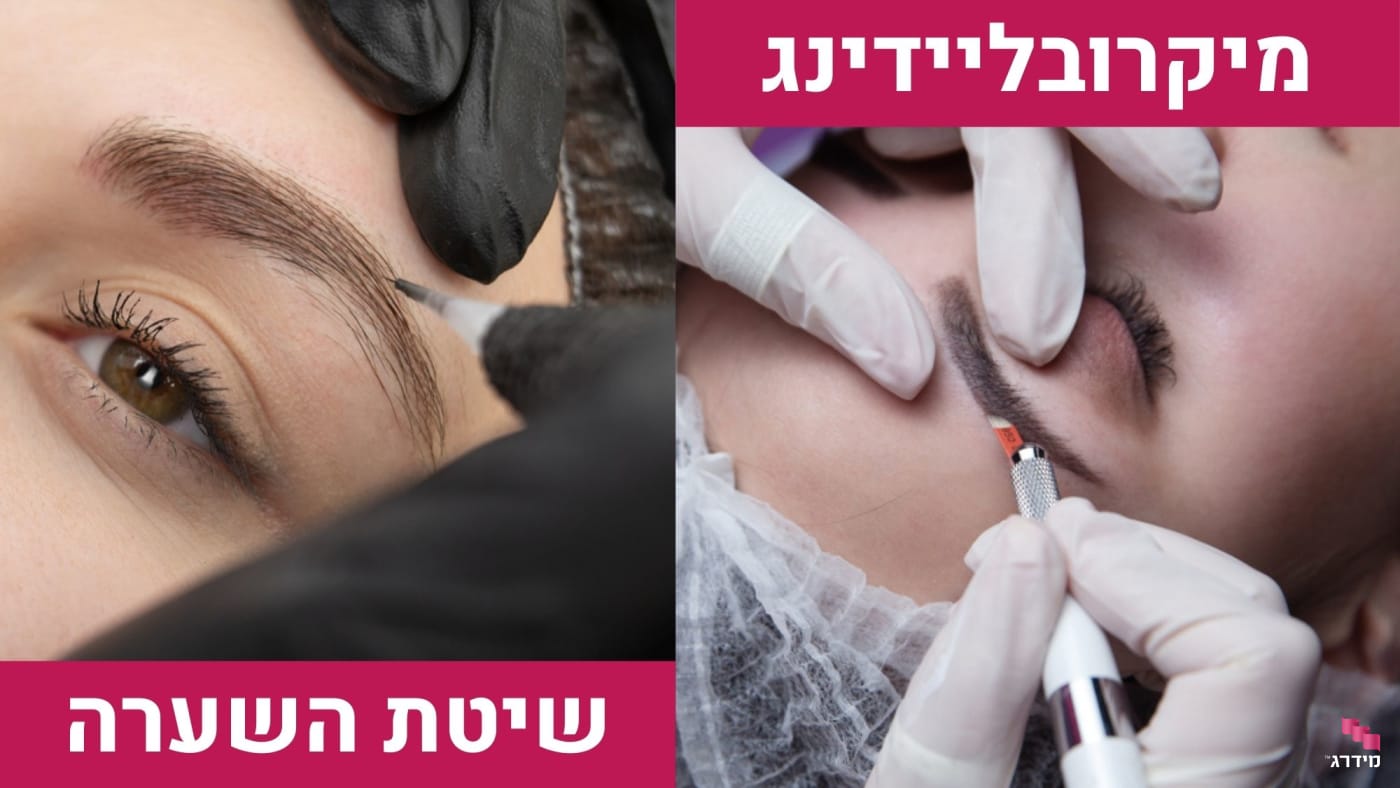 מיקרובליידינג או שיטת השערה