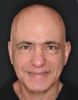 רופא שיניים מומלץ באזור ר"ג-גבעתיים-ב"ב עם 8 חוות דעת