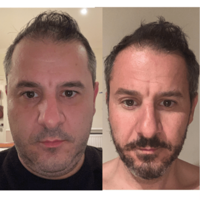 "Ich habe in 12 Wochen 21 kg abgenommen"
