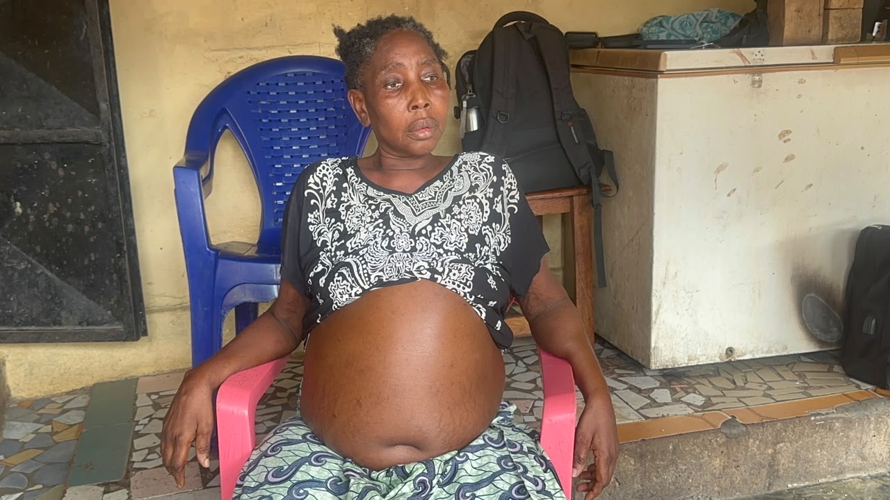 Ventre ballonné de la dame M’mah Kaba