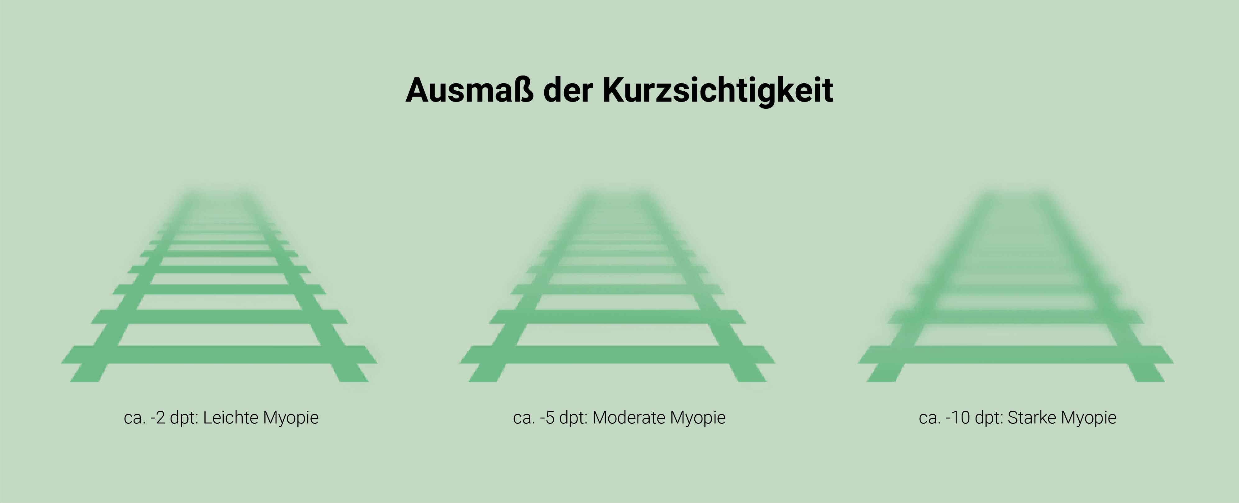 Ausmaß der Kurzsichtigkeit