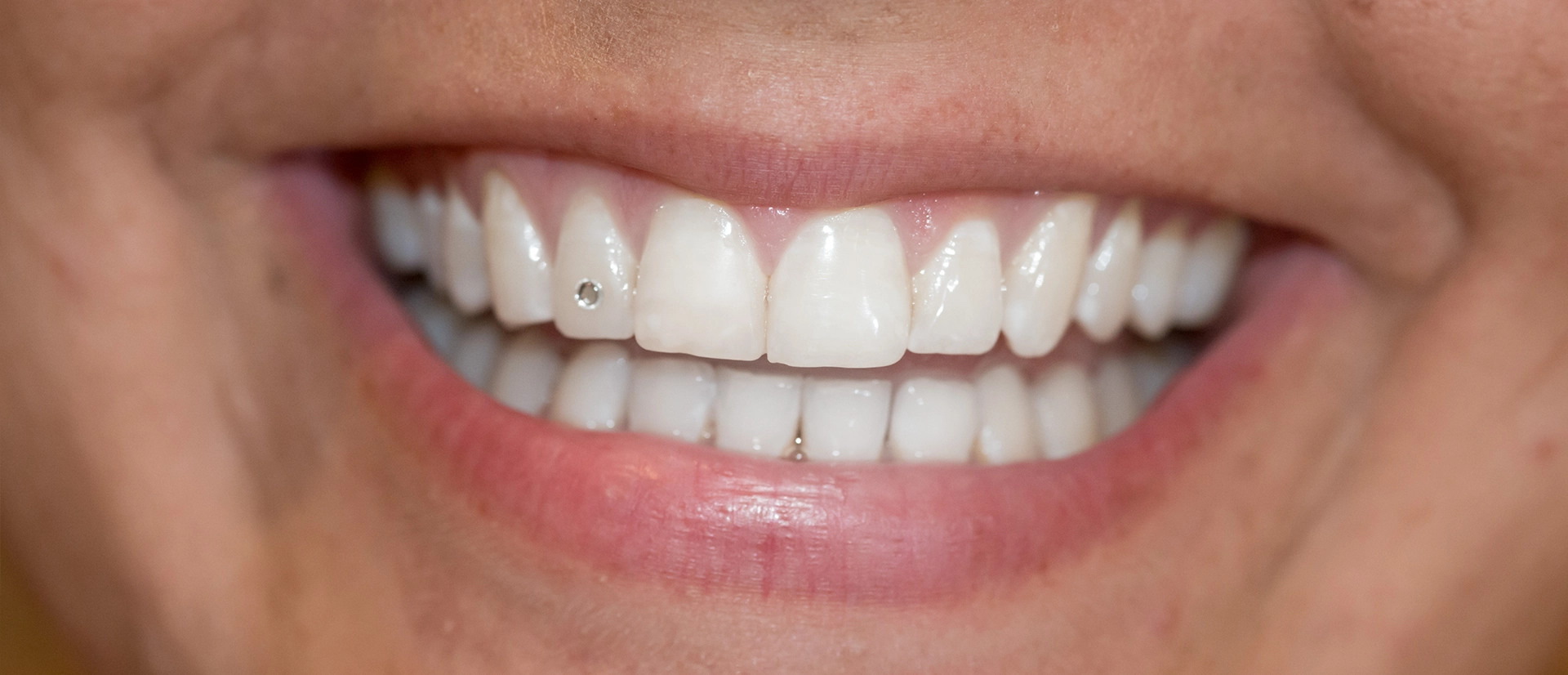 smiling face with a tooth piercing