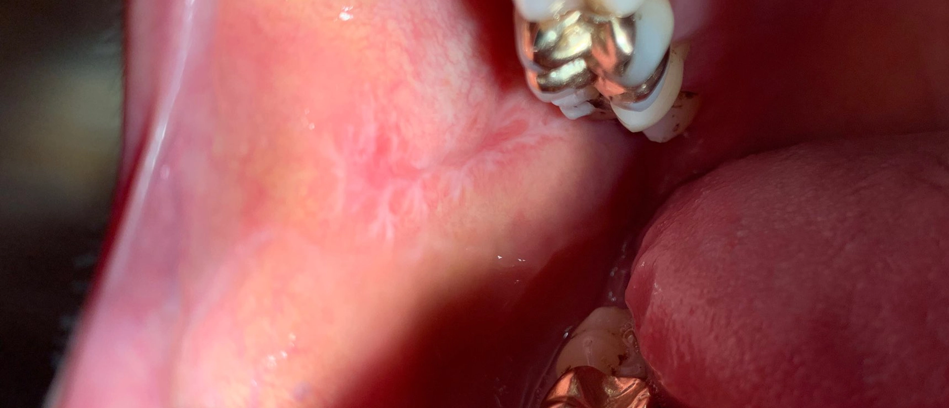 schleimhauterkrankungen