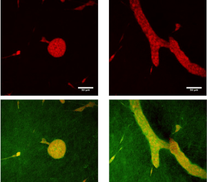 Theoretical approach of ductal morphogenesis