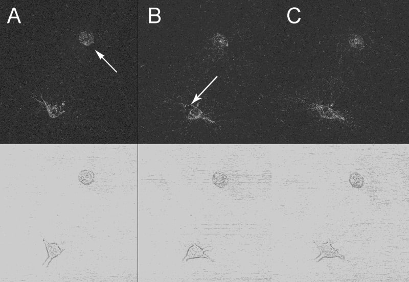 Collagen degradation during early stage
                                            morphogenesis.