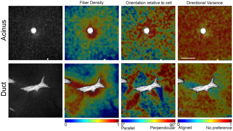  Patterns of collagen fiber organization.