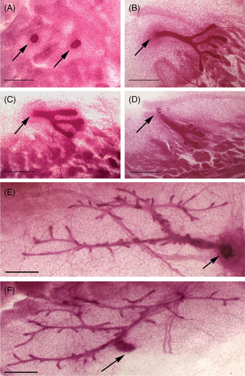 Ductal development in whole mounts
  of mammary glands from C57Bl6 mice illustrates the principle of never identical iterations on the branching pattern of a ductal system. 