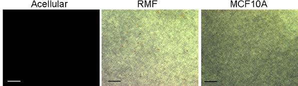 Evidence of cell activity on collagen organization.