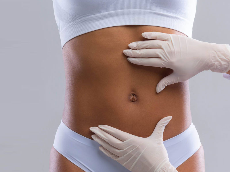 Liposuction Hamburg: Problem Areas & Costs