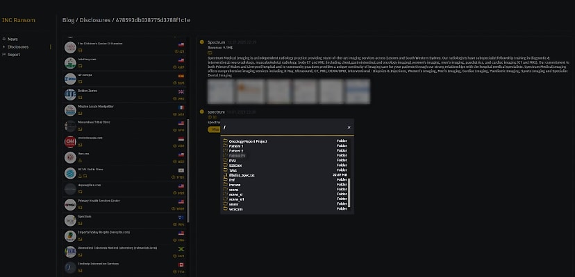 Exclusive: Spectrum Medical Imaging warns patients medical data exposed following ransomware attack