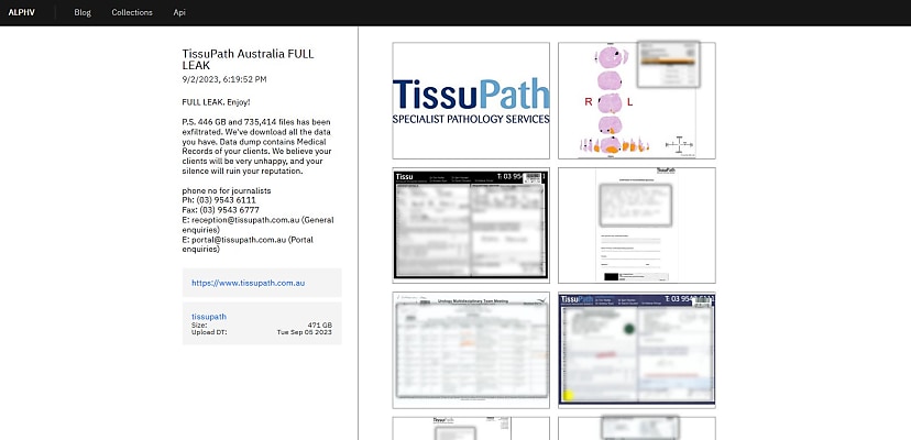 ALPHV’s TissuPath data breach is worse than you think, with over 700,000 files leaked