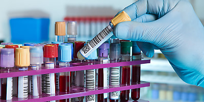 blood vials hr gob8x1