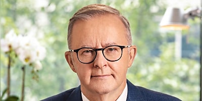 Anthony Albanese 3 reb