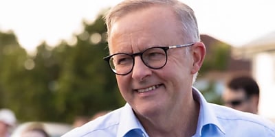 Anthony Albanese 2 smsf