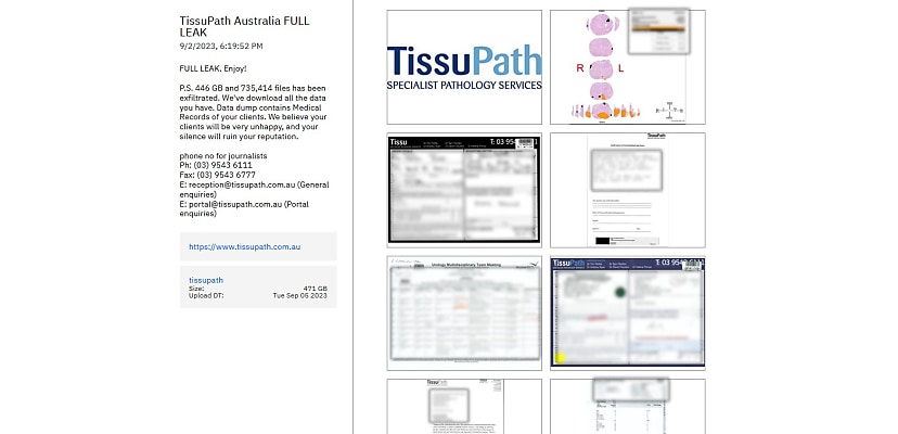 ALPHV’s TissuPath data breach is worse than you think, with over 700,000 files leaked