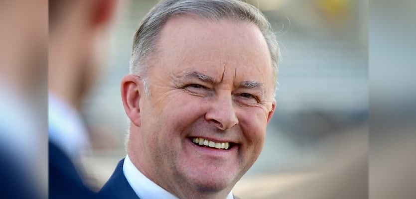 Anthony Albanese reb