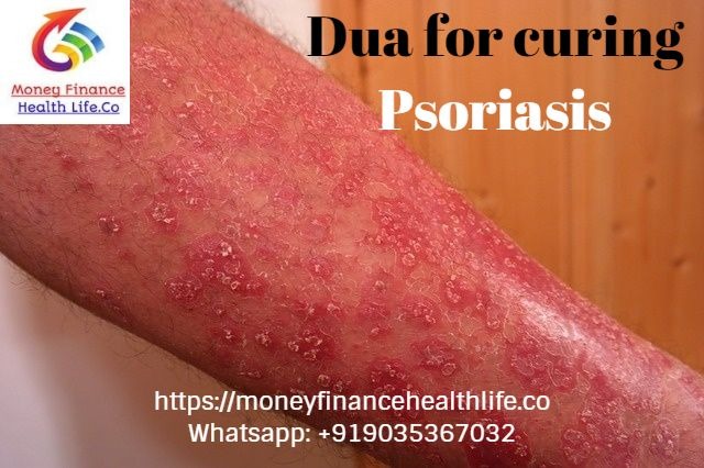 skin psoriasis meaning in urdu