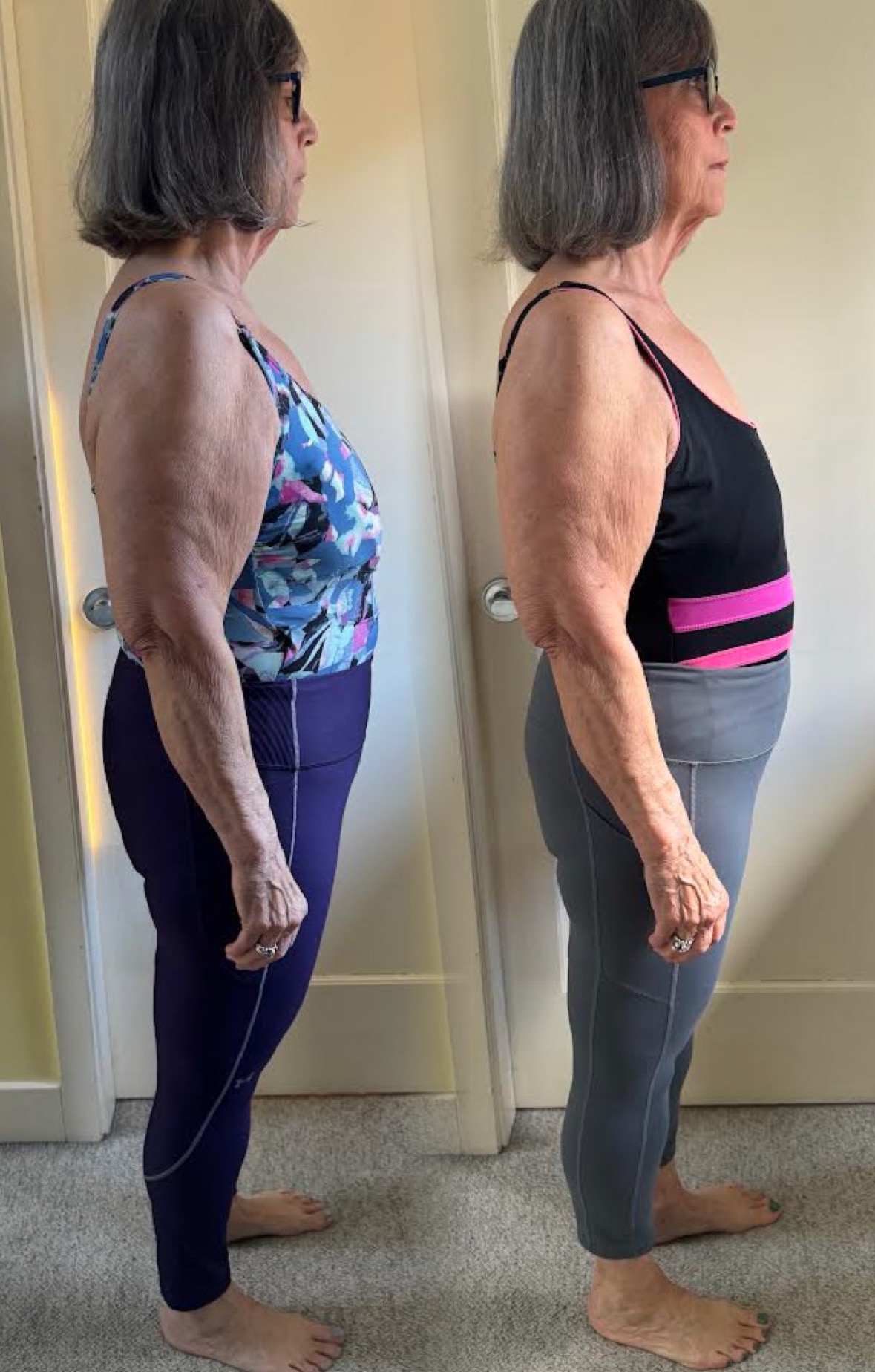 Carol K. testimonial photo