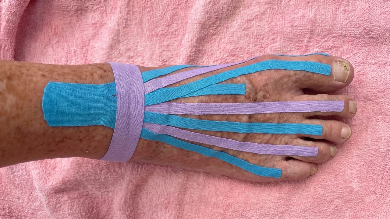 Neuromuscular Taping Knw3gq