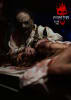 Asphyxia