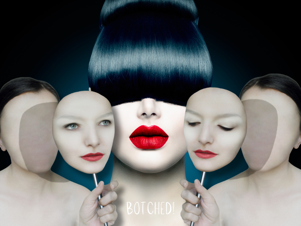 Botched!