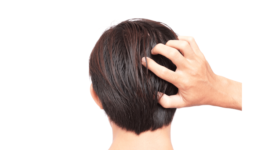 5 Early Signs You Re Going Bald Fight Hair Loss Immediately