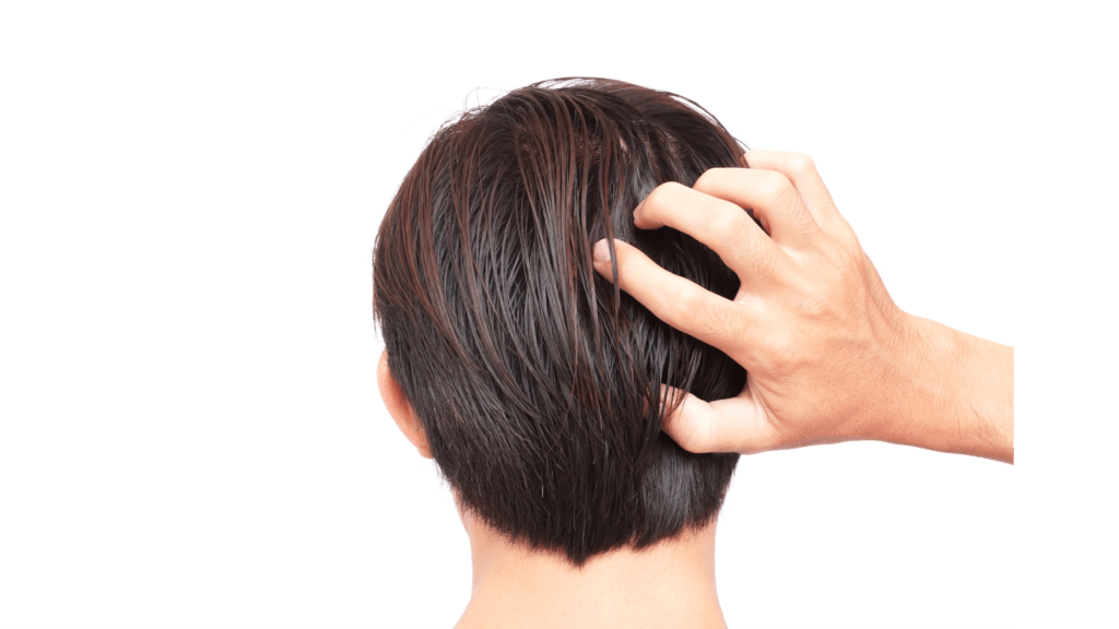 How to get rid of an oily, itchy and dandruff filled scalp?