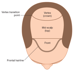 Regiones del cuero cabelludo