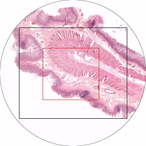 Field of view dow the microscope